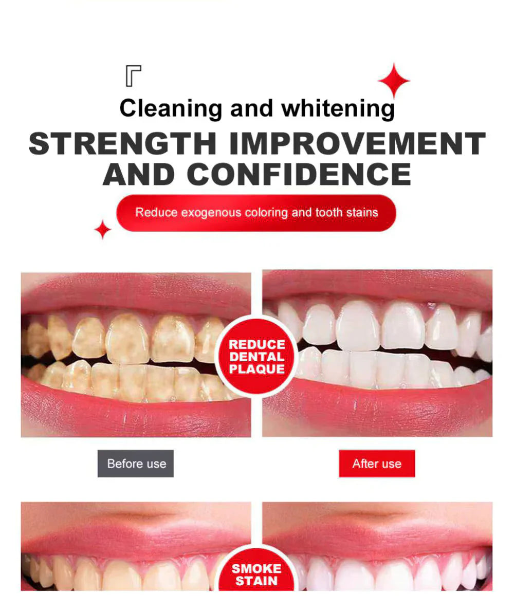 Yayashi SP4 Oral Care Probiotic Whitening Toothpaste 120g โ Shine Brighter, Remove Years of Coffee, Tea & Smoking Stains