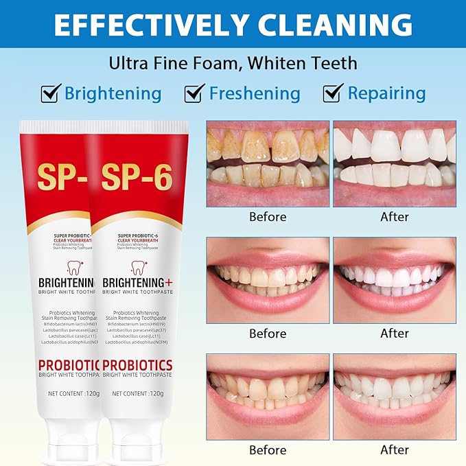 SP4 Oral Care Probiotic Whitening Toothpaste 120g
