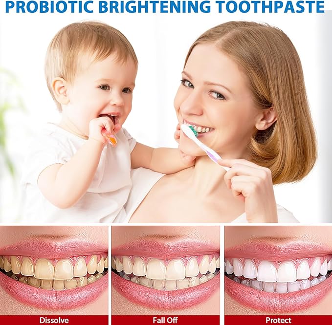 SP4 Oral Care Probiotic Whitening Toothpaste 120g